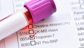 High-Sensitivity Troponin Assays Not All the Same, APACE Data Confirm