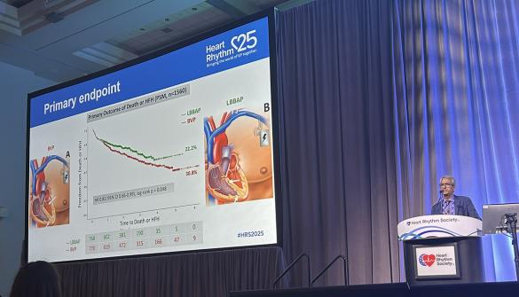 CRT Patients Fare Better With LBB Area vs Biventricular Pacing 
