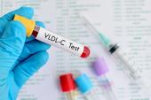 ‘Remnant’ Cholesterol Linked With CVD Risk, Even When LDL Levels Are Low