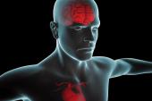 Neurological Prognosis Affects Survival Benefit of Early Intervention After Cardiac Arrest