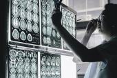 Reducing CV Risk May Improve Brain Health at Any Stage in Life, Studies Hint