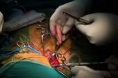 Durability of Surgery, Stenting for Symptomatic Carotid Stenosis Good for Up to a Decade