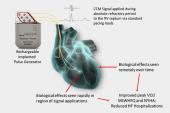 FDA Approves the Optimizer Smart Implantable Pulse Generator for Heart Failure