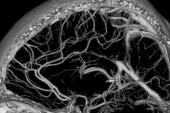https://stock.adobe.com/images/computed-tomography-angiography-of-the-brain-vessels/4926020