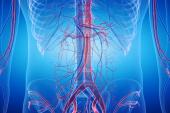 OVER Trial: Long-term Mortality Similar After Endovascular and Open AAA Repair