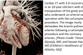 New AUC for Cardiac Imaging Follow-up in Congenital Heart Disease