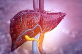 Cirrhosis Tied to Poor Outcomes in the Months After PCI