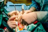 Hospital MV Surgical Volume Not Tied to TMVr Outcomes