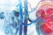 Treating Accessory Arteries May Be Important in Renal Denervation