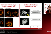 OCT and MRI Find an MI Cause in 85% of Women With MINOCA: HARP