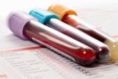 Papers Confirm Rare Thrombocytopenia Link to AstraZeneca Vaccine