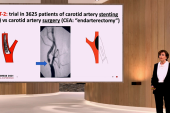 ACST-2: Carotid Stenting, Surgery Provide Similar Outcomes in Asymptomatic Patients