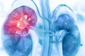 NSTEMI Patients With CKD See Better Outcomes With Invasive Strategy