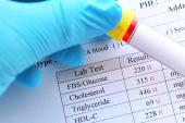 FH Patients Face Unchanging Acute MI Risks Plus Very Late Diagnoses