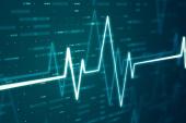 AI-Enabled Algorithm Succeeds in Identifying Diabetes From ECG Data