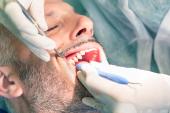 Antibiotics Before Invasive Dental Work Helpful in High-Risk Patients