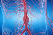 ACC/AHA Release Updated Aortic Disease Guideline