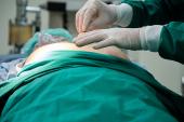 Earlier Extraction for Cardiac Device Infections Tied to Lower Mortality