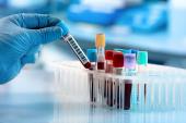 Biomarker and Echo Data Bolster Vutrisiran’s Promise in ATTR-CM