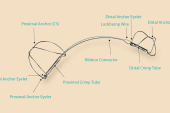 Positive Results With Carillon Mitral Device Seen in Real-world Registries