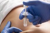 Inclisiran Effective as Monotherapy for Lower-Risk Primary Prevention