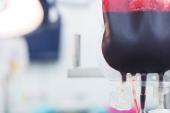 Liberal Transfusion Strategy for Acute MI and Anemia Doesn’t Impact QoL