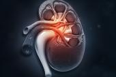 CMS Issues Proposed Coverage Decision for Renal Denervation