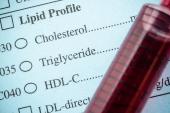 ESC/EAS Stress Early LDL-Lowering in Select High-risk Patients