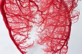 Dig Deeper When Dealing With Nonobstructive CAD, AHA Urges