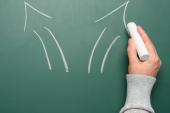 ACASA-TAVI and NOTION-4 Trials Give Mixed Messages on DOACs After TAVI