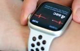 Smartwatch Increases AF Diagnosis in Older, High-risk Patients: EQUAL