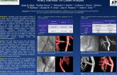 Tridimensional Rotational Angiography and Transplant Renal Artery Stenosis: 40 Cases Analysis.