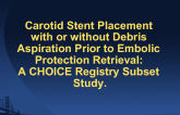 Carotid Stent Placement (CAS) with or without Debris Aspiration Prior to Embolic Protection (EDP) Retrieval: A CHOICE Registry Subset Study.
