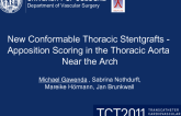 New Conformable Thoracic Stentgraft (SG) – Apposition Scoring in the Thoracic Aorta Near the Arch