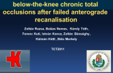 Retrograde transpedal access for below-the-knee chronic total occlusions after failed anterograde recanalisation