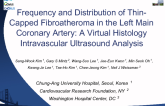 Frequency and Distribution of Thin-Capped Fibroatheroma in the Left Main Coronary Artery: A Virtual Histology Intravascular Ultrasound Analysis