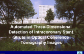 Automated Three-Dimensional Detection of Intracoronary Stent Struts in Optical Coherence Tomography Images