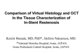 Comparison of Virtual Histology and OCT in the Tissue Characterization of In-Stent Restenosis.