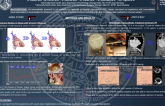 Interventional Perspective of Tricuspid Regurgitation: Heterotopic Percutaneous Valve Implantation From Preclinical Trials to First-in-Man Application
