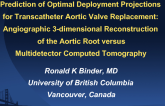 Prediction of Optimal Deployment Projections in Transcatheter Aortic Valve Replacement: Angiographic 3-Dimensional Reconstruction of the Aortic Root versus Multidetector...