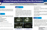 The Impact of Commissural Morphology on Clinical Outcome in Patients Undergoing Percutaneous Balloon Mitral Valvuloplasty