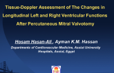 Tissue-Doppler Assessment of The Changes in Longitudinal Left and Right Ventricular Functions After Percutaneous Mitral Valvotomy