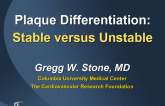 The Future of Plaque Differentiation: Stable versus Unstable