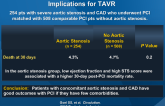 PCI in Patients with Severe Aortic Stenosis: Implications for TAVR