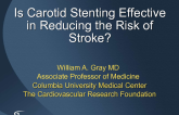 Is Carotid Stenting Effective in Reducing the Risk of Stroke?