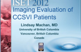 Imaging Evaluation of CCSVI Patients