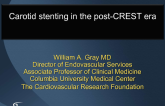 Carotid Stent in the Post-CREST Era