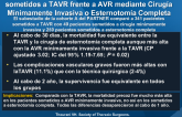 Resultados a Corto y Medio Plazo en Pacientes sometidos a TAVR frente a AVR mediante Cirugía Mínimamente Invasiva o Esternotomía Completa