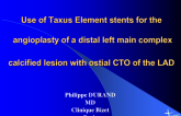 Use of Taxus Element Stents for the Angioplasty of a Distal Left Main Complex Lesion with Ostial CTO of the LAD