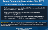 3-D Aortic Annular CT Predicts Moderate, Severe Paravalvular Regurgitation After TAVR